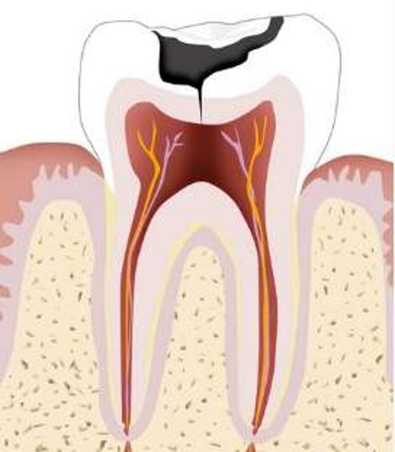 经常喝饮料对身体有哪些危害,红茶饮料跟绿茶饮料哪个危害大