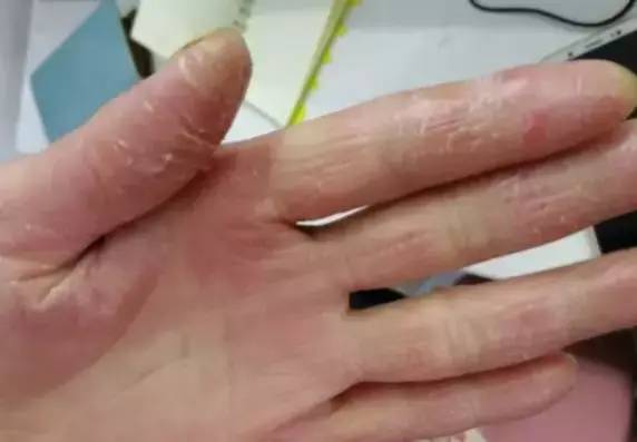 小白鞋容易脏一招让它干净又亮,小白鞋发黄用这招一刷就亮白如新