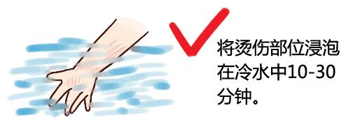 小猫被烫伤了涂什么药,孩子被开水烫伤擦什么