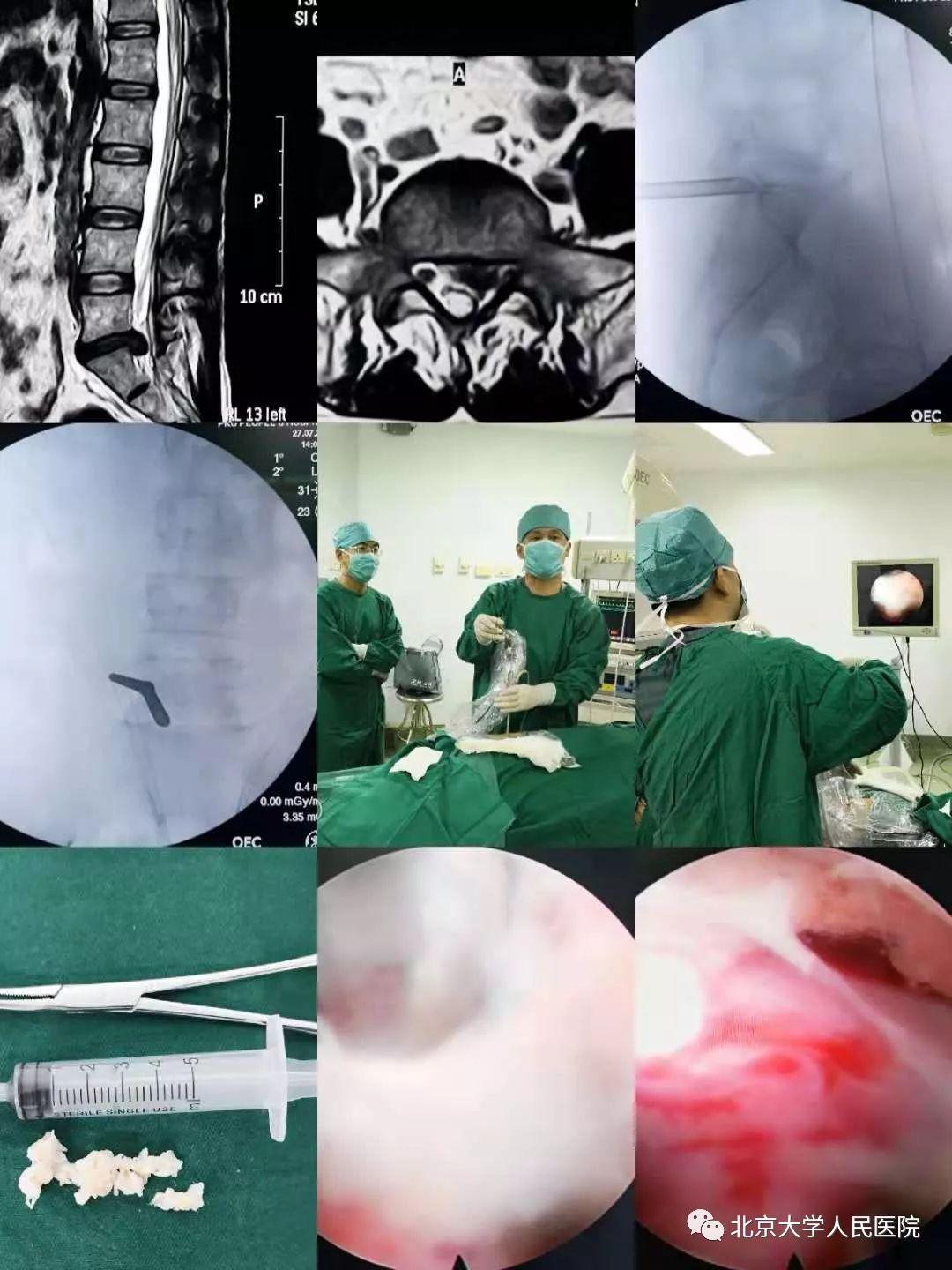 科普胸痛千万不要大意,医生科普疼痛科