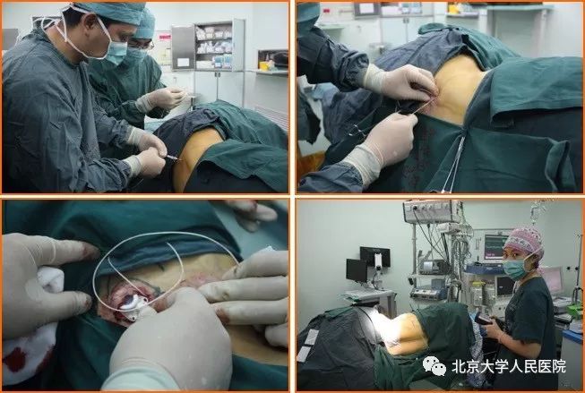 科普胸痛千万不要大意,医生科普疼痛科