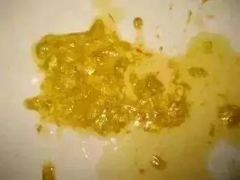 药师说药流感防护措施,药师说儿童抗生素