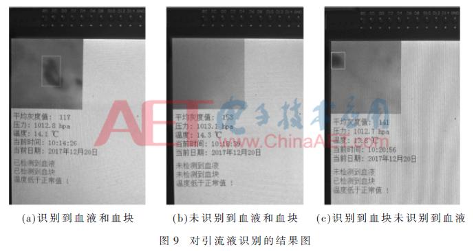 膀胱手术后膀胱冲洗,术后膀胱冲洗需要多少费用