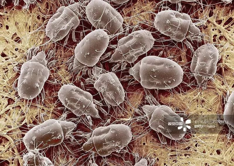 人脸上螨虫的数量,人脸上有多少螨虫