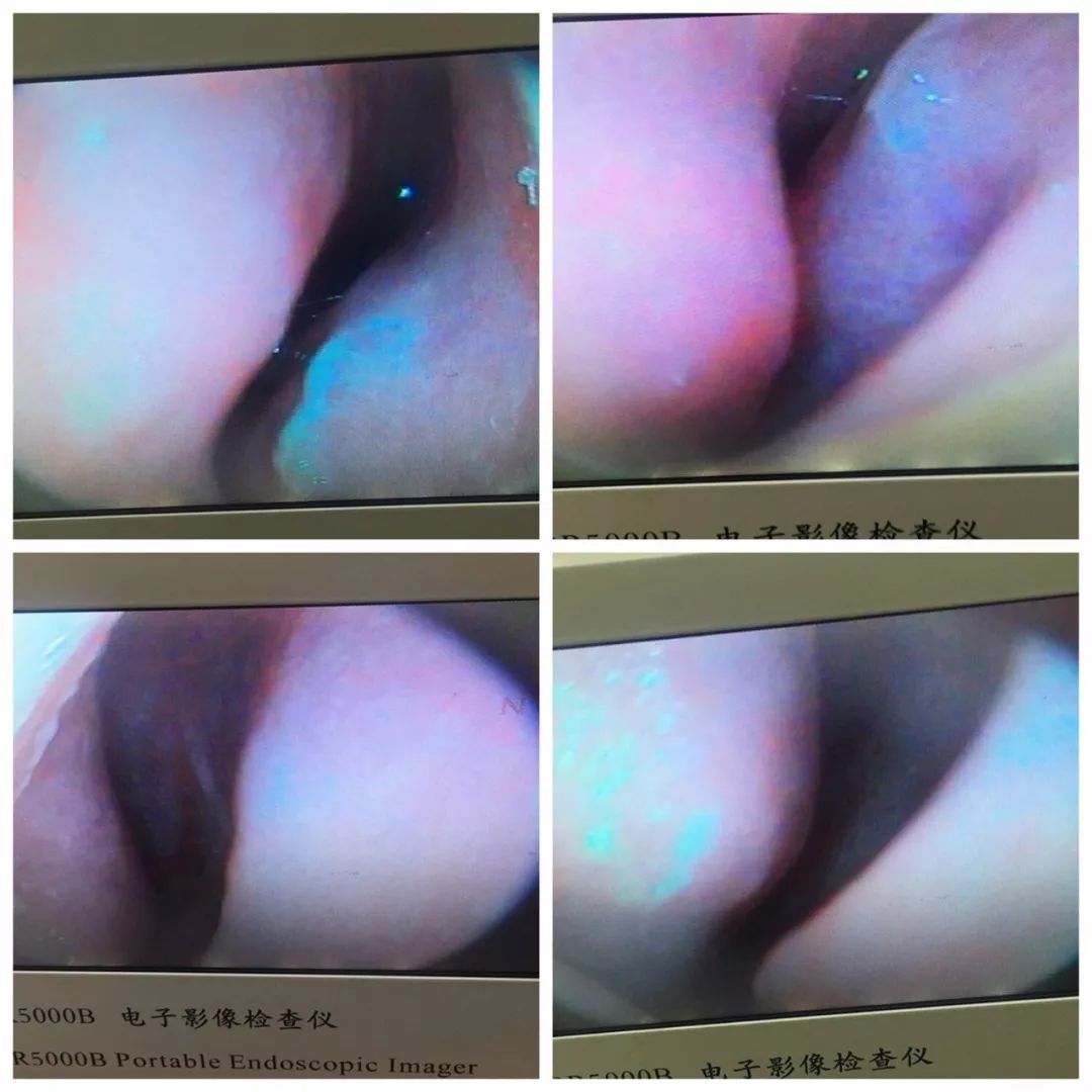 四退原则出炉：“无论什么原因，鼻炎治不好就退款！”常州这家诊所打了谁的脸？