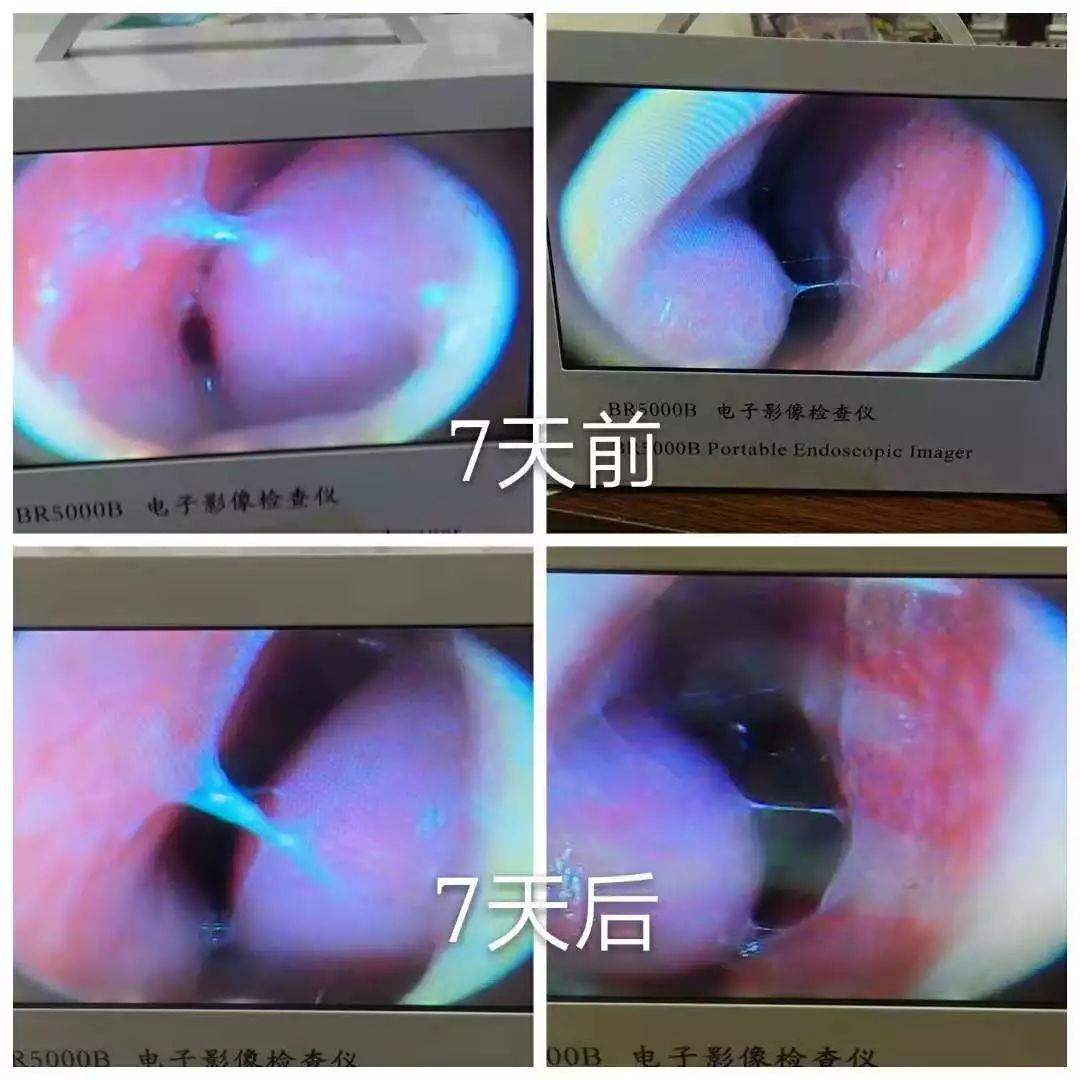 四退原则出炉：“无论什么原因，鼻炎治不好就退款！”常州这家诊所打了谁的脸？