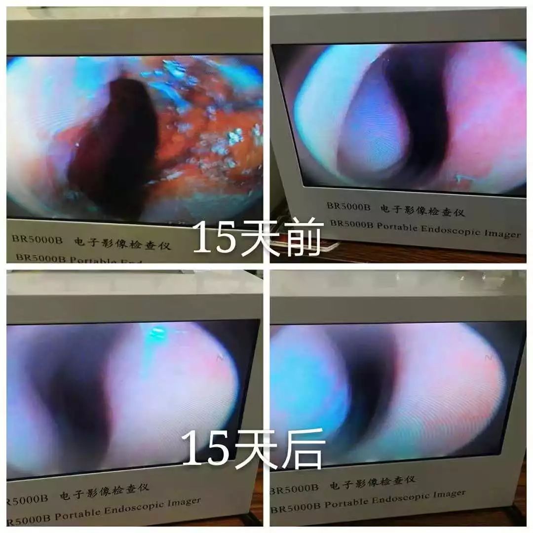 四退原则出炉：“无论什么原因，鼻炎治不好就退款！”常州这家诊所打了谁的脸？