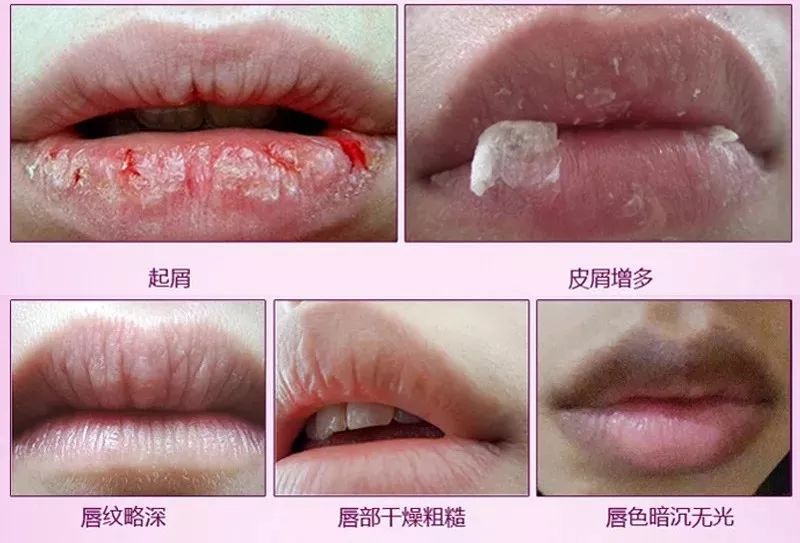 嘴唇干裂？世界最昂贵“液体钻石”，恢复水润，告别唇部细纹！