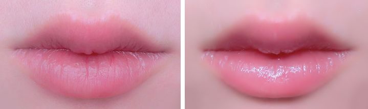 嘴唇干裂？世界最昂贵“液体钻石”，恢复水润，告别唇部细纹！