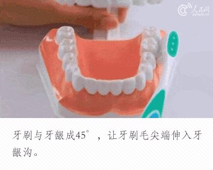 花了一万元做牙齿很难看,花了60万做的牙齿