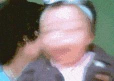 终于知道胳膊上的疤痕是怎么来的,终于知道为什么手臂上有疤了