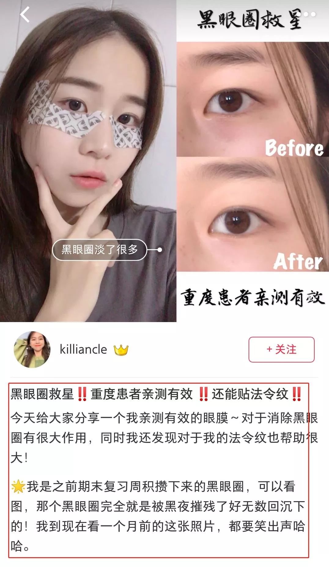 半个娱乐圈都用的面膜有多神奇,熬夜党必备的眼膜拯救你的黑眼圈