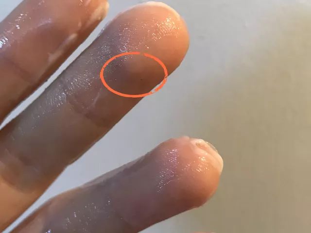 最有效去黑头和洁面的产品,你用过最好用的去黑头的产品