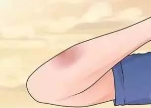 碘酒跟红药水的功能区别,碘酒和红药水区别