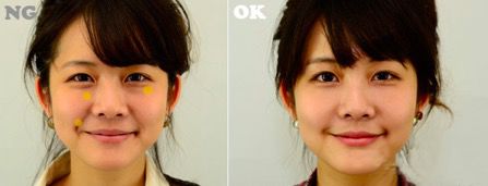 法令纹会让自己显老5到10岁,法令纹显老十岁教你解决