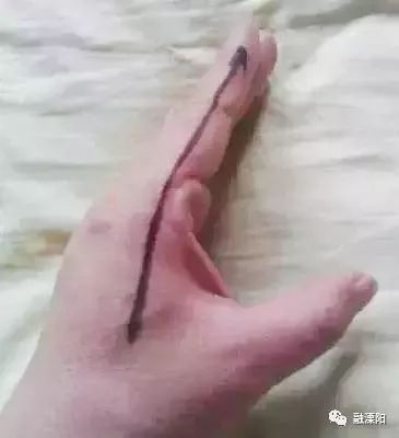 胃痛咳嗽出血吃什么中药材好,胃疼便秘中医绝学