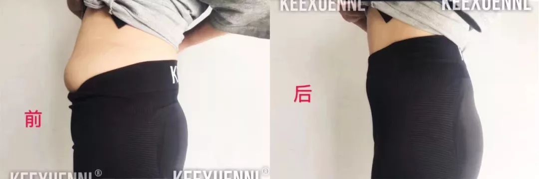 穿瘦腿袜运动能瘦腿吗,瘦腿袜能矫正腿型吗