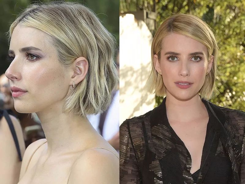 脖子为什么会有一道杠,脖子上出现几道杠会得什么病