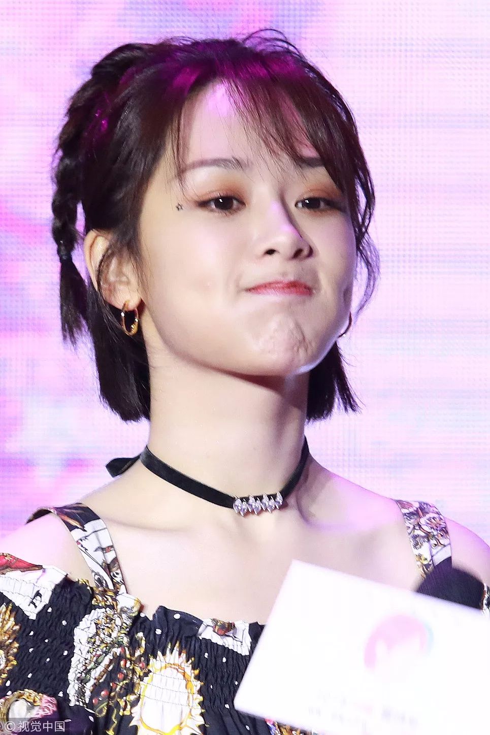 脖子为什么会有一道杠,脖子上出现几道杠会得什么病