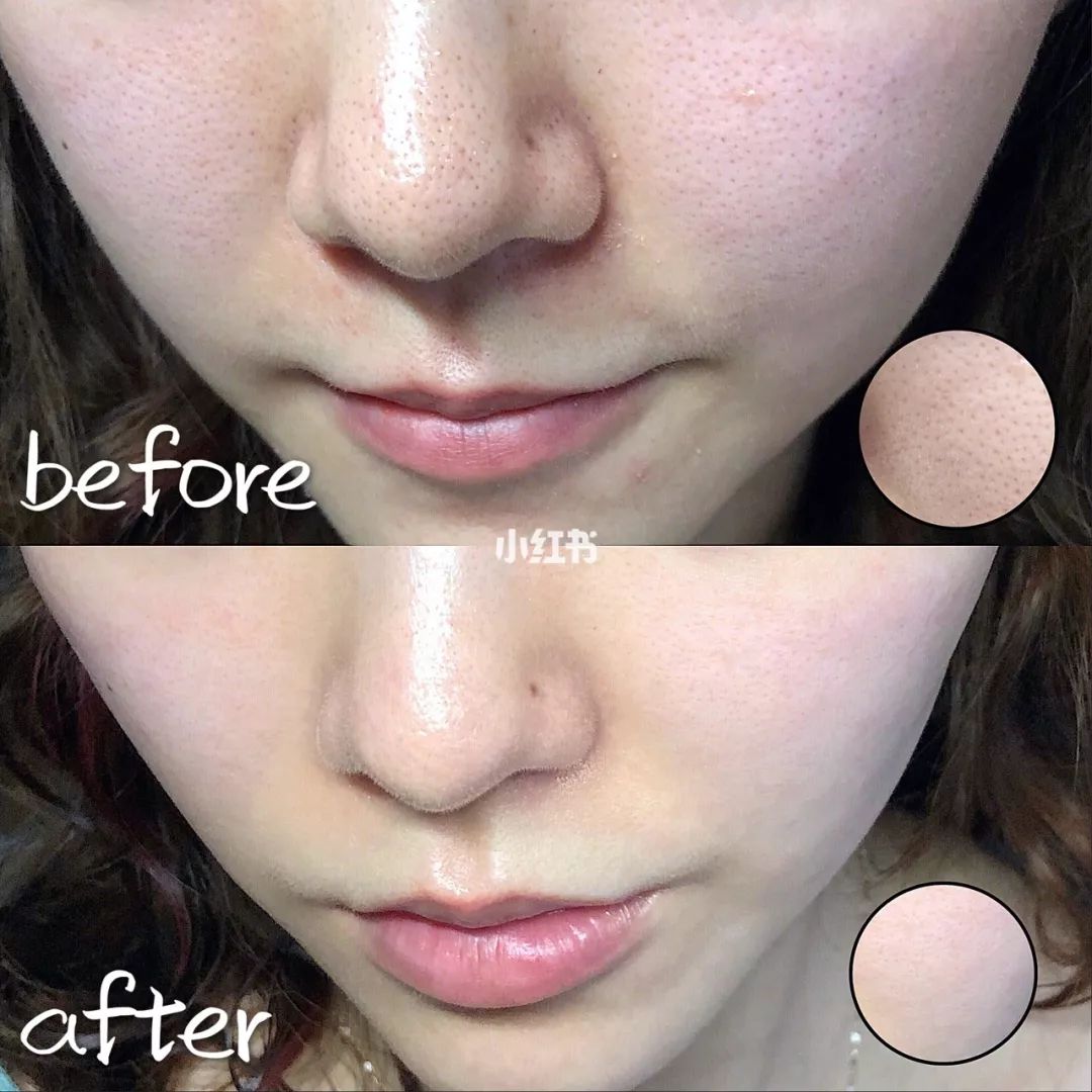 磨皮神器隐形毛孔真实效果,粗毛孔去黑头测评