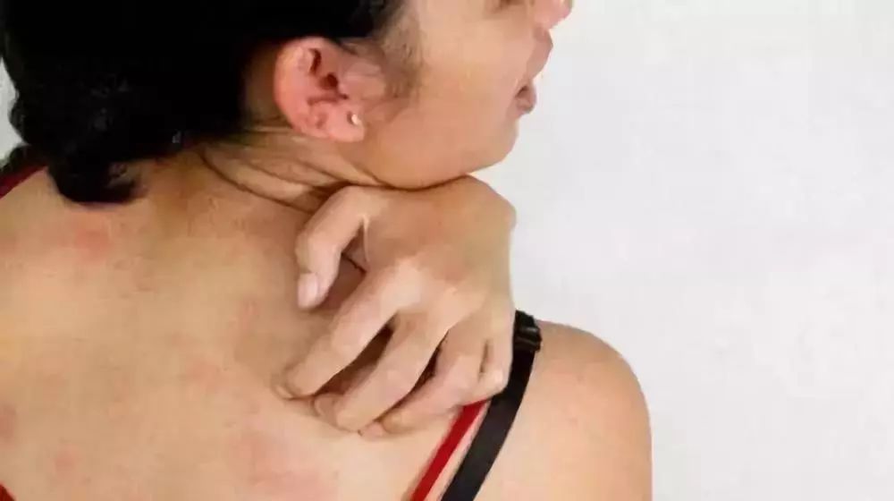 有北极熊绒毛的衣服吗,有了羽绒服不会冷了