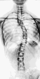 日常生活注意调整坐姿,不保持正确健康坐姿的危害