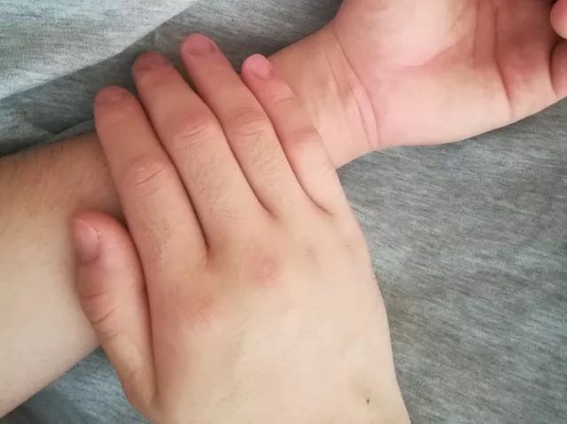 透析病人内瘘胀痛是怎么回事,透析病人内瘘血栓形成如何处理