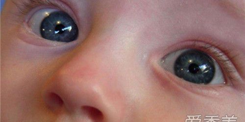 鼻子会越挤越大吗,鼻子会越捏越高吗