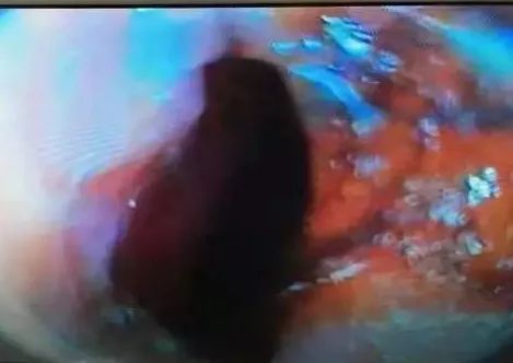 四退原则出炉：“无论什么原因，鼻炎治不好就退款！”常州这家诊所打了谁的脸？