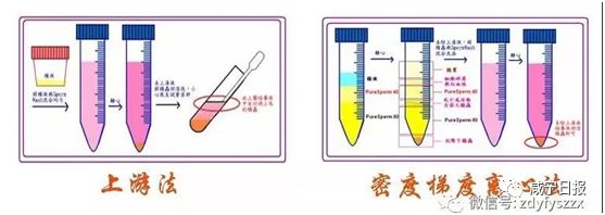 今天想跟你聊聊“羞羞”的事儿，和精子卵子有关