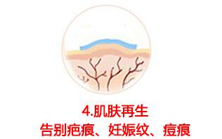 斑疤痘敏妊娠纹,伤痕印如何能快速消除