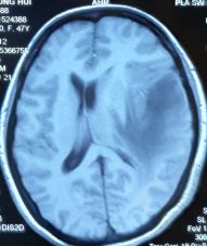 因祸得福第二集,因祸得福上下集免费