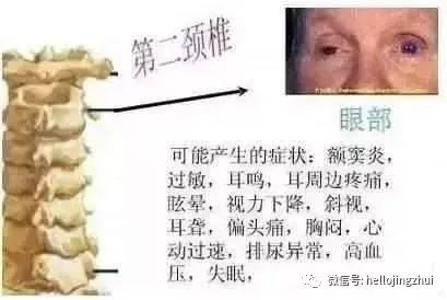 颈椎病压迫神经吃甲钴胺多长时间,颈椎病压迫神经微创手术要多少钱