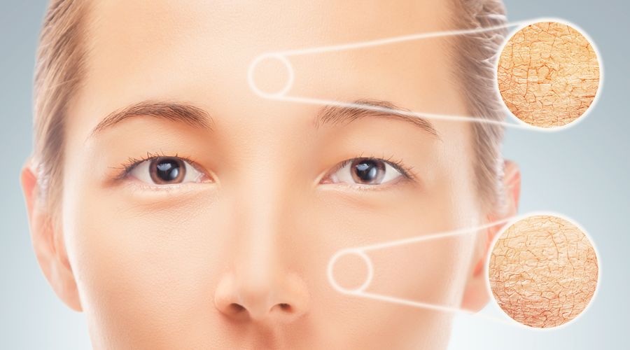 皮肤出现3个迹象暗示癌症,皮肤出现四种信号