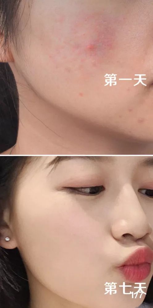 20天变白！这瓶国宝级神器居然只要几十元