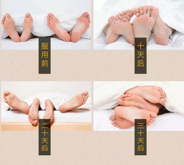 注意补肾之前要自测是否肾虚,肾虚补肾的最佳方法年轻人好治吗