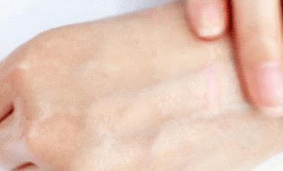 适合黑皮和黄皮的面膜,适合黄皮的mm面膜