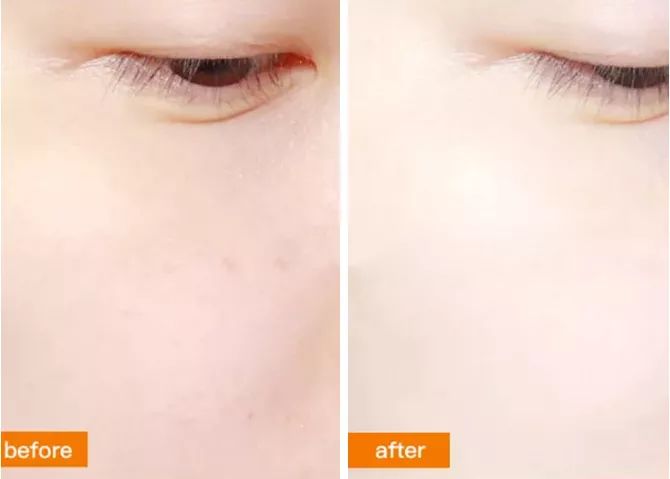 补水保湿滋润肌肤面膜10片装一盒,安瓶精华水润透亮睡眠面膜