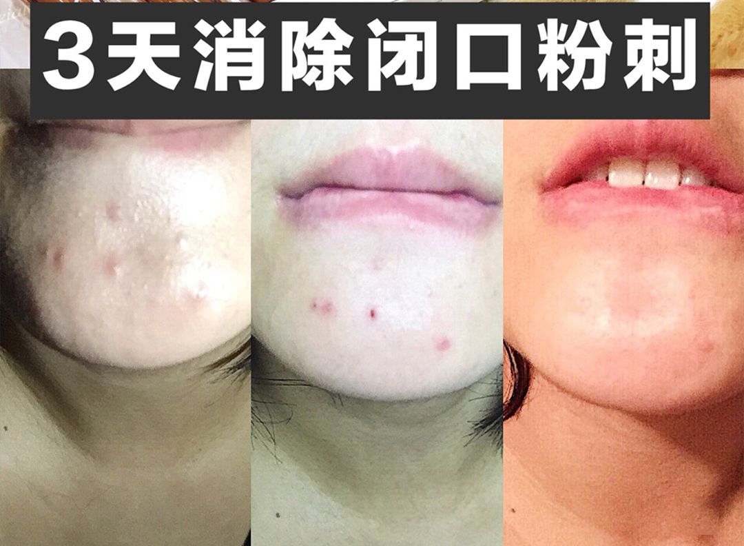 补水保湿滋润肌肤面膜10片装一盒,安瓶精华水润透亮睡眠面膜