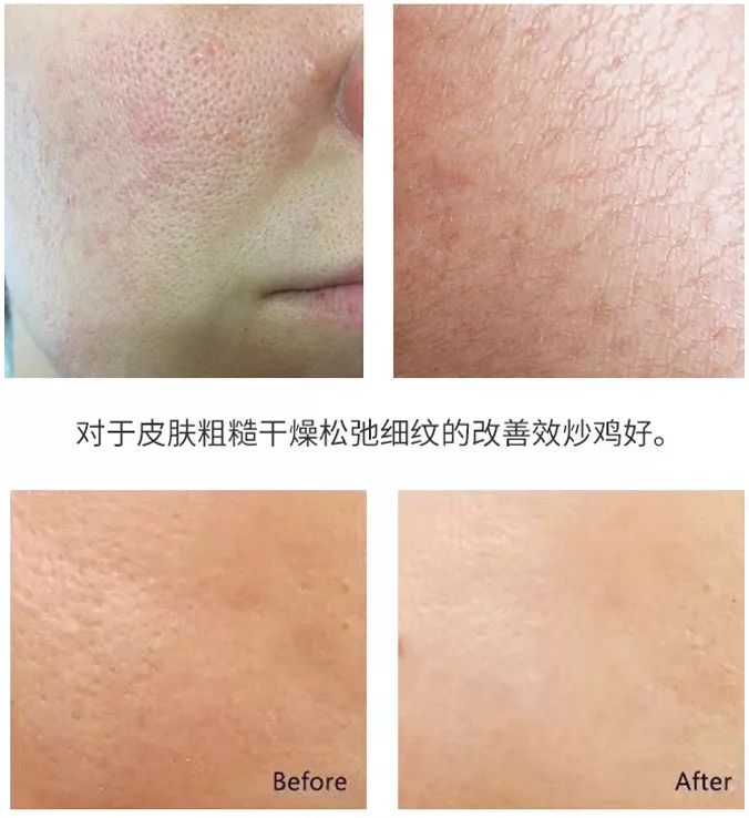 补水保湿滋润肌肤面膜10片装一盒,安瓶精华水润透亮睡眠面膜