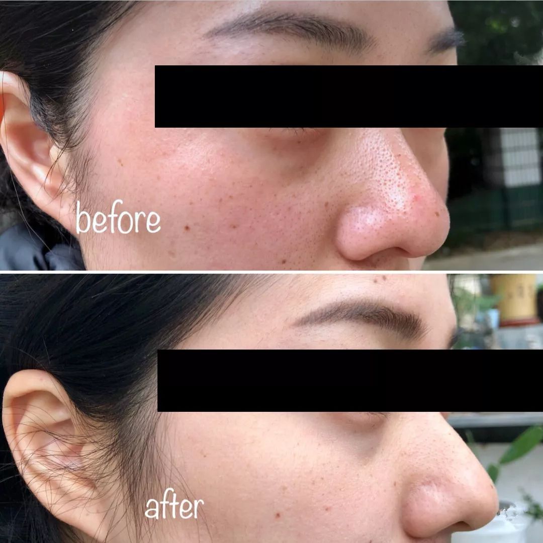 补水保湿滋润肌肤面膜10片装一盒,安瓶精华水润透亮睡眠面膜