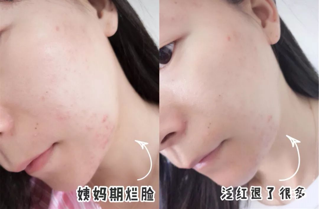 补水保湿滋润肌肤面膜10片装一盒,安瓶精华水润透亮睡眠面膜