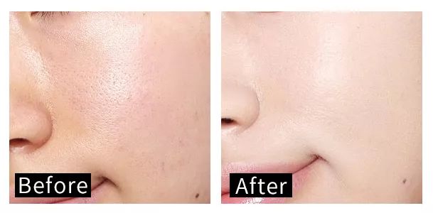 1000ml才100多的发酵水，补水修复效果秒千元大牌，什么来头？