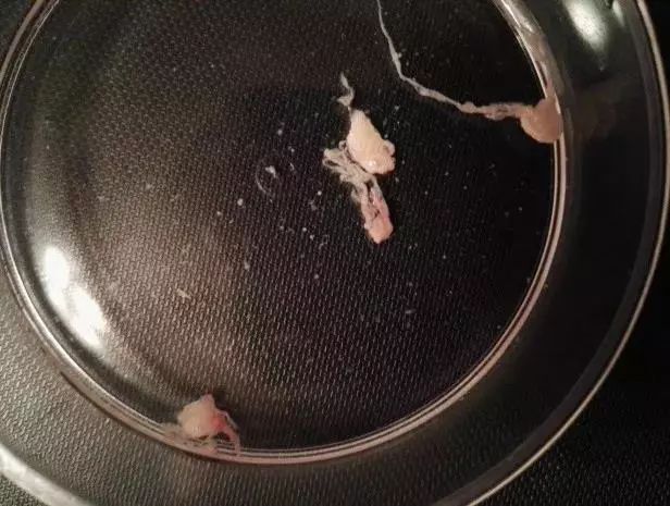 肺癌美国治疗的全部经过,肺癌指南中文版2020完整版