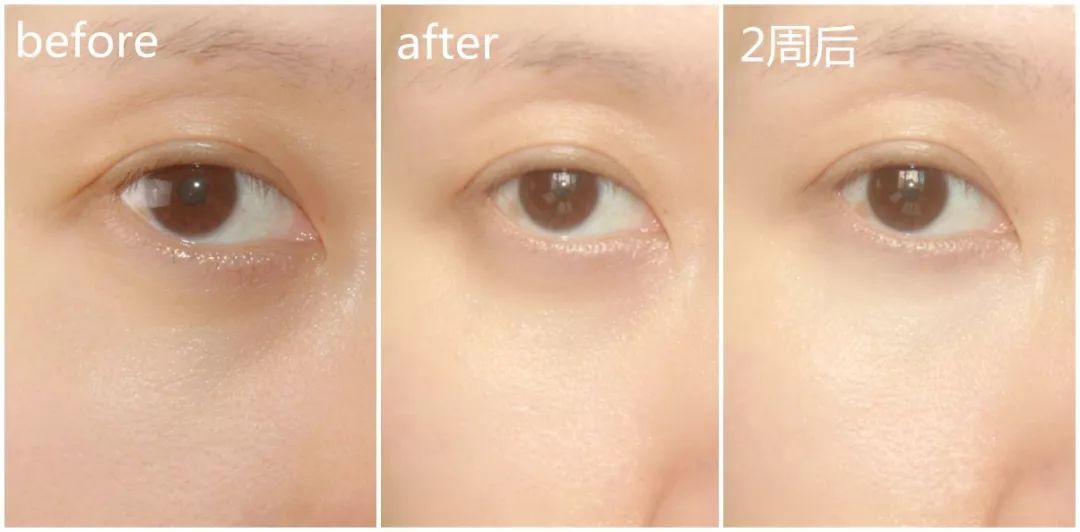 明星同款兰蔻必买清单,兰蔻最爆款单品