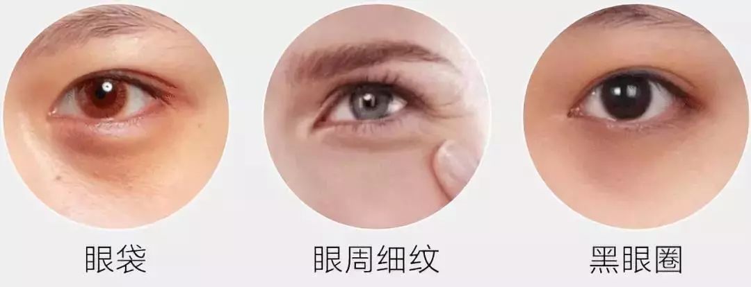 中药抗皱眼膜,30-40岁抗皱紧致眼膜割眼袋
