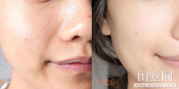 蜂王浆精华的作用与功效,蜂王浆精华效果怎么样