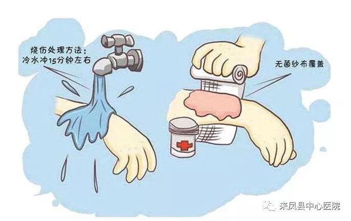 烧伤后抹酱油洒草灰,No!正确处理方式看这里