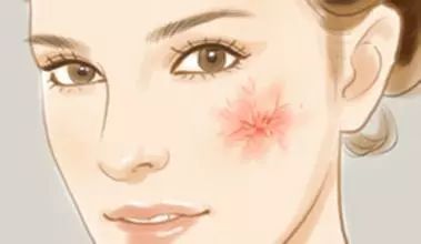 身上出现小红痣是肝不好的原因吗,身上有小红痣不痛不痒是怎么回事