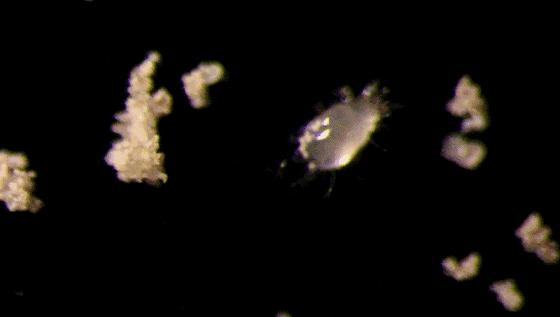 钢丝球上的细菌,钢丝球容易滋生细菌